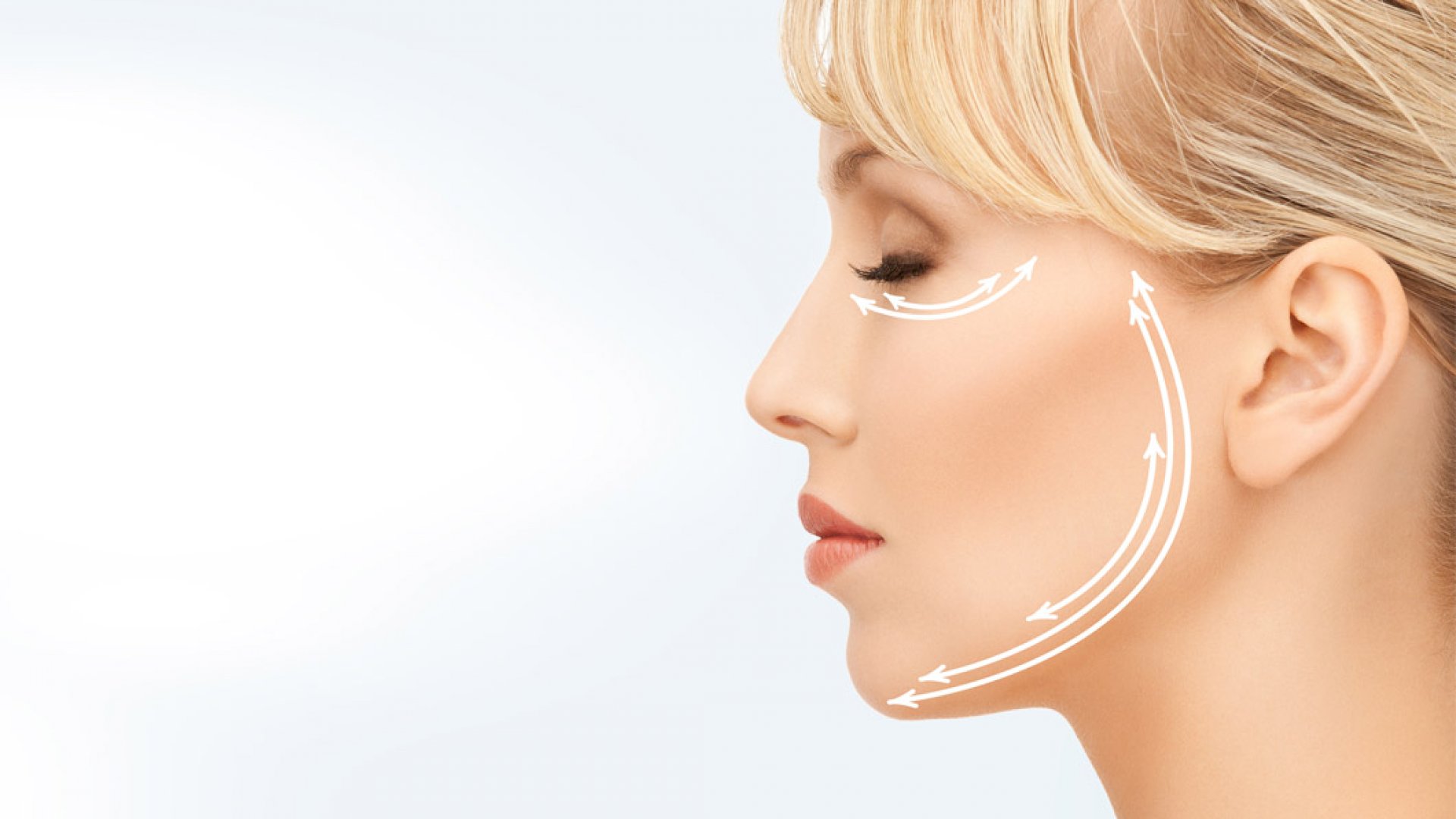 Arcfiatalító műtét Budapesten MACS Facelift MACS Facelift kezelés Budapesten