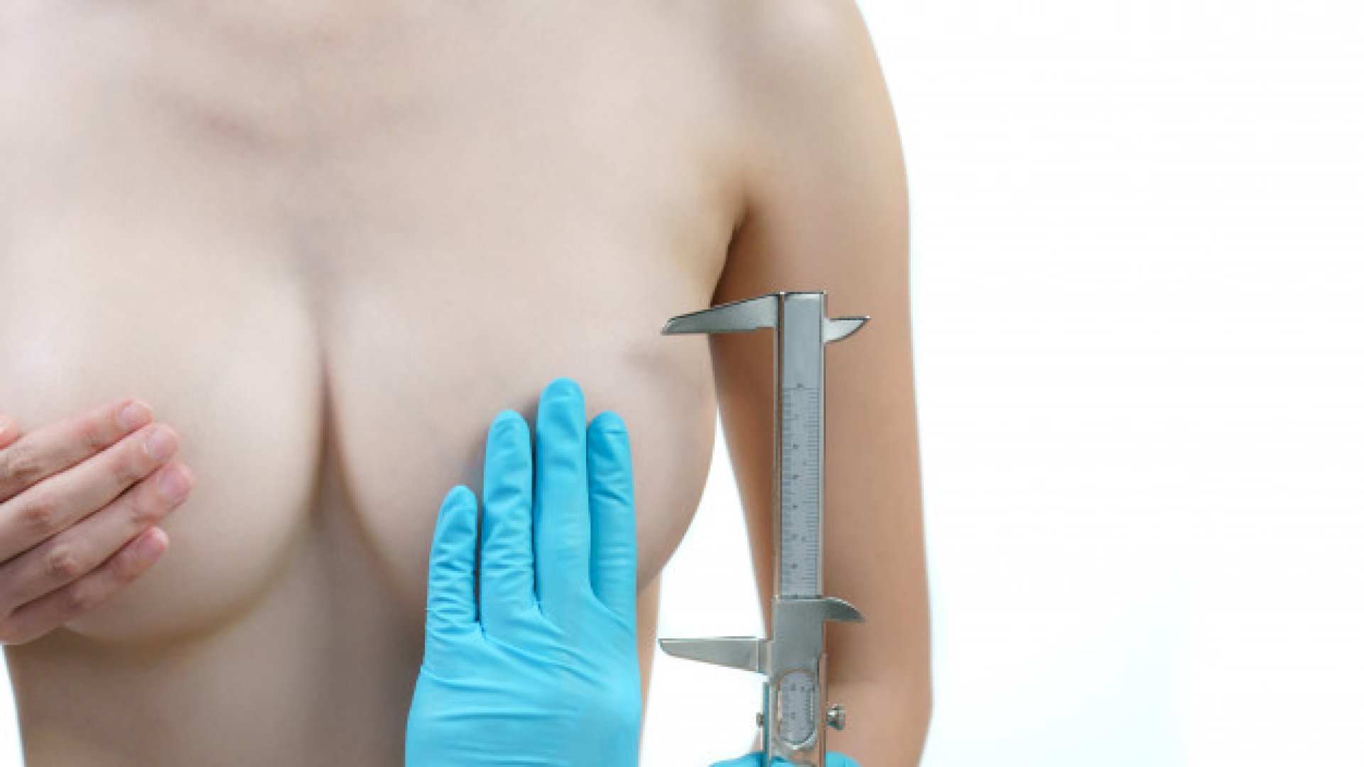 Mellimplantátum felülvizsgálat: mikor érdemes a csere? Mikor érdemes a mellimplantátum cseréje?